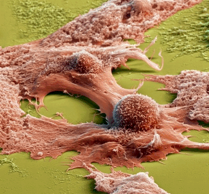 Image: Colored scanning electron micrograph (SEM) of liver cells (Photo courtesy of the Eye of Science).